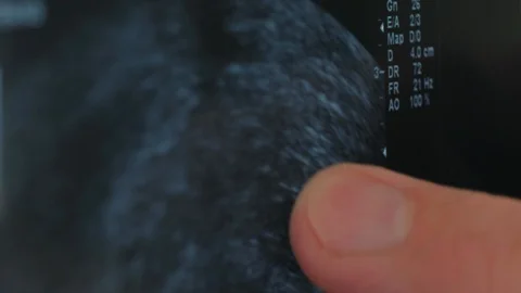 Close-up view of a doctor looking at an X-Ray Video stock 87004327