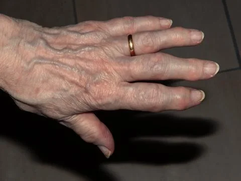 Close-up view of an elderly caucasian person's hand with visible signs of agi Fotos Stock