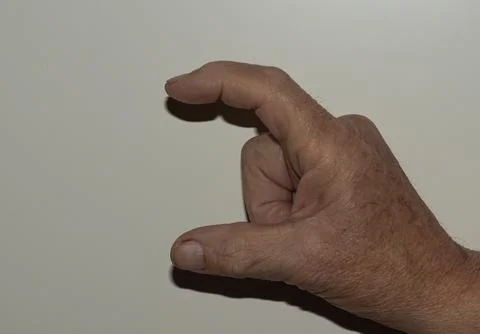 Close-up view of an elderly person's hand with partially closed fingers, su.. Stock Photos