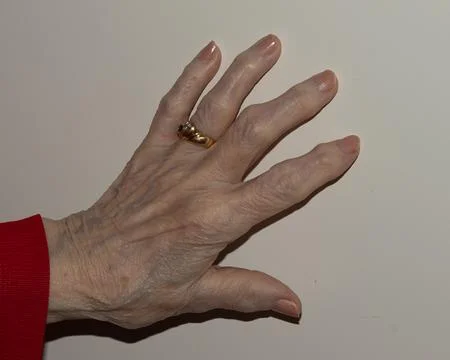 Close-up view of an elderly woman's hand, showing detailed skin texture and.. 写真素材