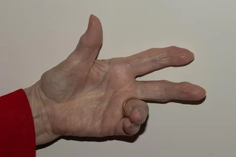 Close-up view of an elderly woman's hand showing the number three, emphasiz.. Stock Photos