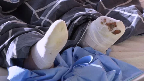 Close up view emphasizes the aged and dry skin texture of an elderly person's ha Stock Footage 328589757