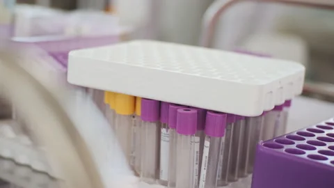 Close-up view of empty blood collection tubes with purple and yellow caps Stock Footage 158583733