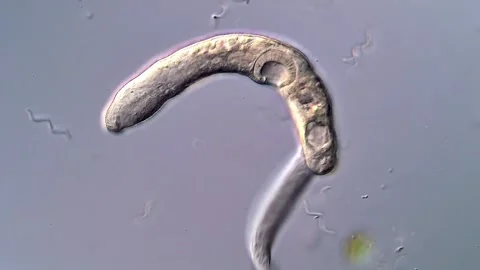 Close-up View of Fluke Larvae Swimming under Microscope 库存影片 317223600