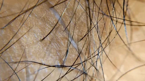 Close-up view of hair on the surface of human skin Stock Footage 339787471