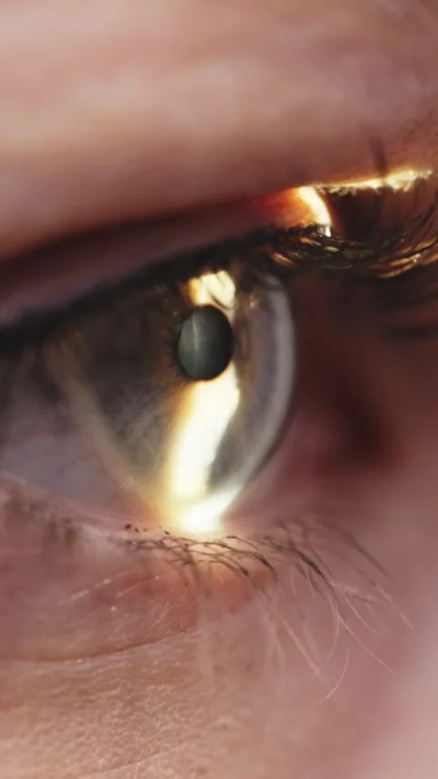 Close-up view of a human eye during biomicroscopy, showcasing pupil dilation and Stock Footage 337386258