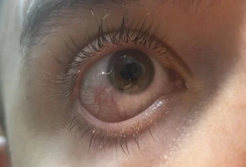 Close-up view of a human eye with visible veins, highlighting the intricate Stock Photos
