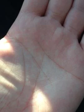 A close-up view of a human hand showing skin texture and palm lines, illuminated 库存照片