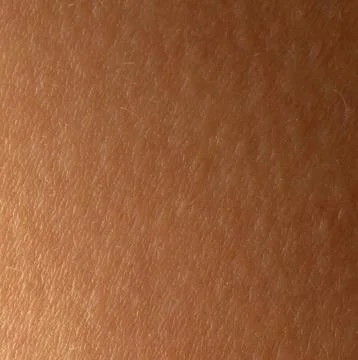 Close-up view of human skin texture in natural light during daytime Foto stock