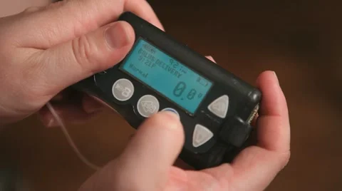 Close up view of Insulin Pump Stock Footage 11135798