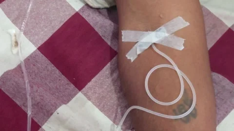 Close-up view of an intravenous IV line taped to a patient's arm as saline fluid Video stock 342477441