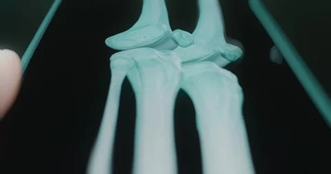 Close up view of knee bones in anatomy app Stock Footage 313839092