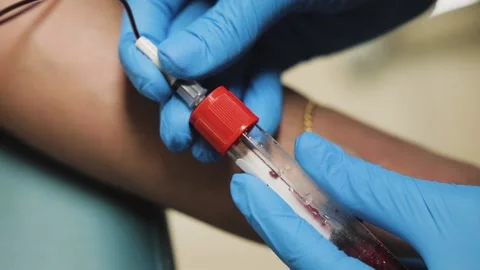 Close up view of Lab Worker hands Extracts blood from vein. a stream of blood Stock Footage 220506183