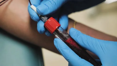 Close up view of Lab Worker hands Extracts blood from vein. a stream of blood Stock Footage 220507070