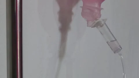 Close Up View of Liquid Dripping Inside Intravenous Drip Chamber: A Realistic Ac Stock Footage 342477440