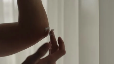 Close-up view of male hands applying moisturizing cream to dry elbow skin Stock Footage 297627404