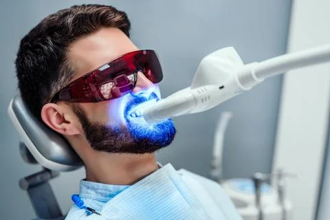 Close up view of man undergoing laser tooth whitening treatment to remove sta Foto stock