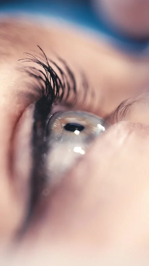 Close-up view of an ophthalmic surgeon performing delicate eye surgery, focusing Stock Footage 337386230
