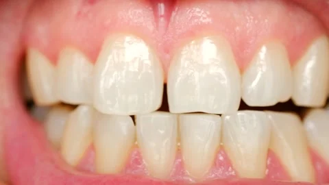 Close up view of a persons teeth clenching repeatedly Stock Footage 311940821