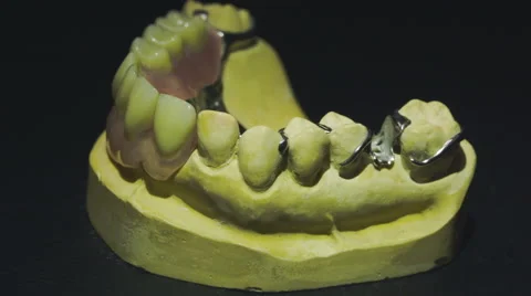 Close up view of ready denture 2 Stock-Footage 48920959