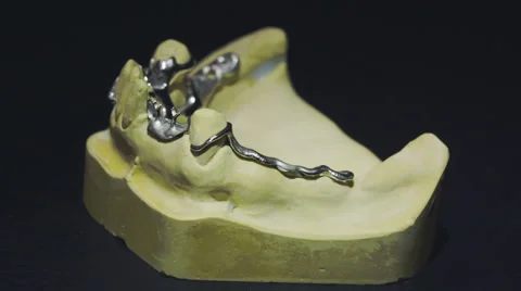 Close up view of ready denture 3 Stock Footage 48921017