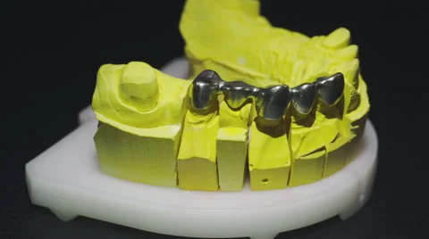 Close up view of ready denture 4 Stock Footage 48921100