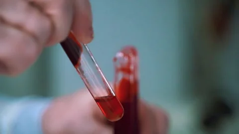 Close up view of researcher's hands analyzing blood samples inside a laboratory Stock Footage 328793952