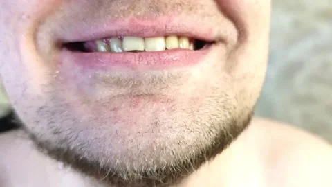 Close-up view shows a mans teeth and goatee Video stock 305491304