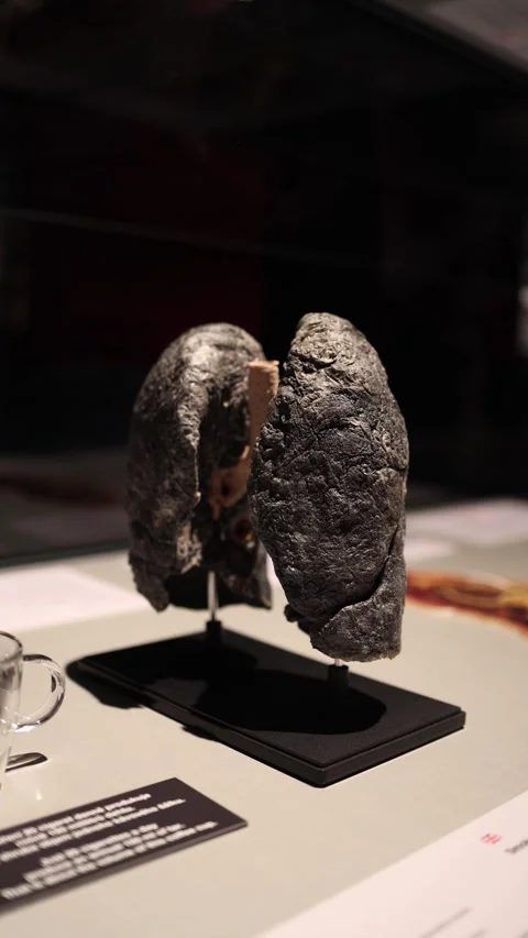Close view of smoking damaged lungs with heavy contamination 스톡 동영상 332163748