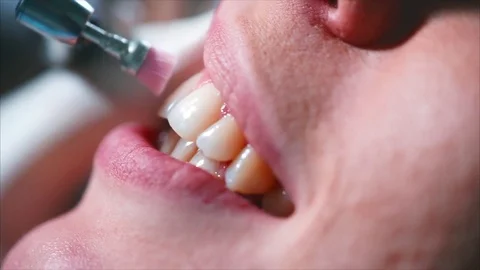 Close up view of teeth cleaning in dental cabinet. Females teeth Stock Footage 76876199