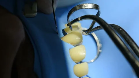 Close-up view of teeth  in dental cabine. Video stock 90675009