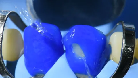 Close-up view of teeth  in dental cabine. Video stock 90675014