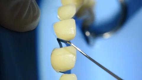 Close-up view of teeth  in dental cabine. Stock Footage 90675017