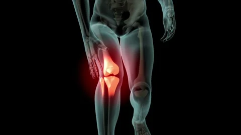 Close-up view transparent human body showing spinal pain against a black 库存影片 336580316