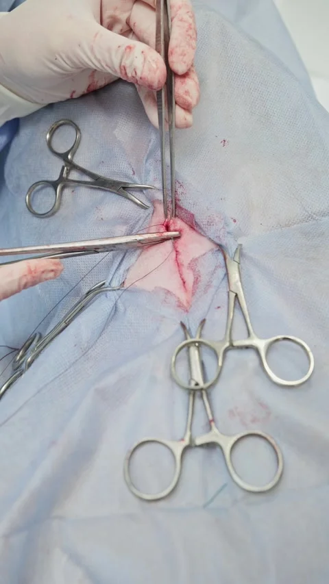 Close-up view of a veterinary surgeon's hands suturing a wound on a dog after a Stock-Footage 341704631