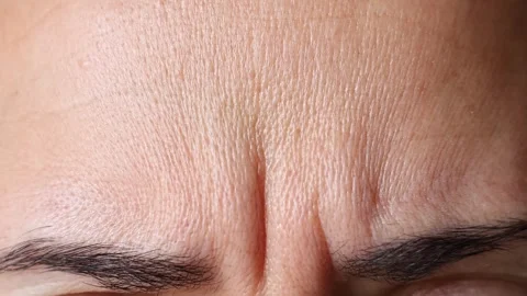 Close up view of woman forehead. Macro shot of middle aged female wrinkles. Stock Footage 311892390