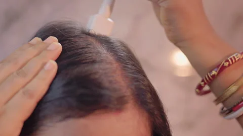 Close view of a woman using derma stamp on hair roots for scalp therapy. Stock Footage 333698517