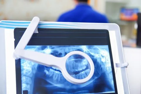 Close up of a view of x-ray image of teeth structure, medical concept Stock-Fotos