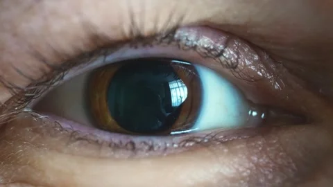 Close-up views of an eye. dilated pupils after ophthalmologist drops Stock Footage 332212590