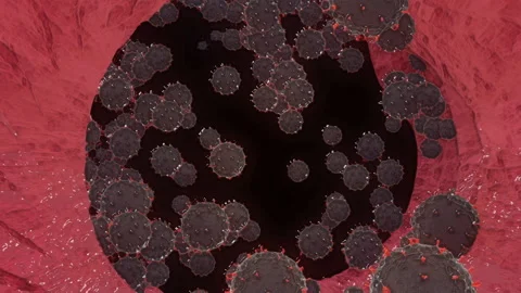 Close-up of virus in lungs body  under microscope., SARS-CoV-2 COVID-19 pandemic Stock Footage 158549020