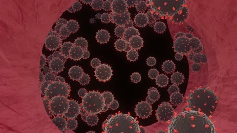 Close-up of virus in lungs body  under microscope., SARS-CoV-2 COVID-19 pandemic Stock Footage 158612024