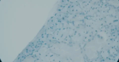Close-Up of Viruses and Bacteria Under Microscope Stock Footage 318593010