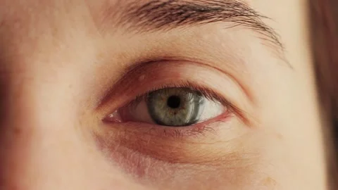 Close-up of a watery eye with green iris. Female face footage. Stock Footage 313982155