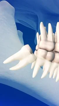 Close-up of wisdom teeth pain concept Stockillustratie