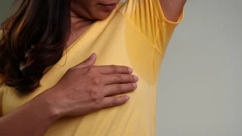 Close-up woman with hyperhidrosis sweating. Stock Footage 146166668