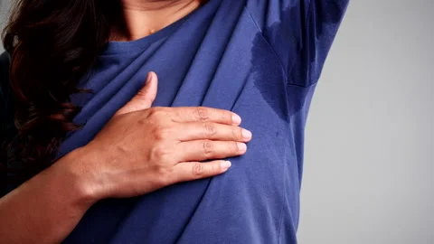 Close-up woman with hyperhidrosis sweating. Stock Footage 146166826