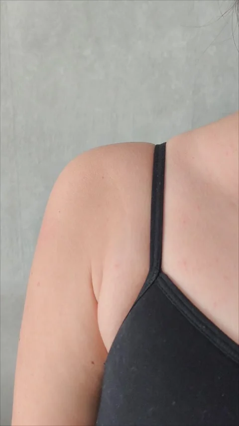 Close up of woman pulling excess fat on her skin underarm she problem armpit fat Stock Footage 313521277
