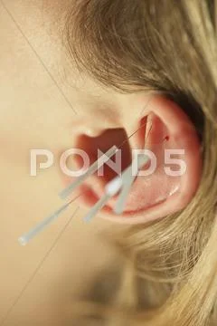 Close-Up Of Woman Receiving Acupuncture On Ear