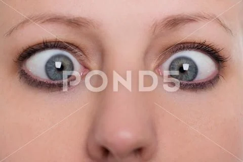 Close up, woman is squinting, concept strabismus and squint Stock Photos