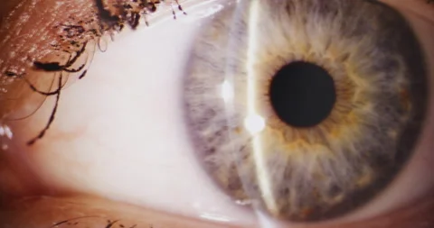 Close-up of Womans Eye During Examination Stock Footage 310803097
